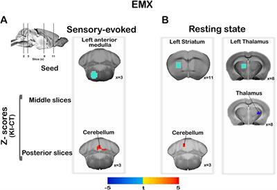 Altered functional brain connectivity in Dyt1 knock-in mouse models